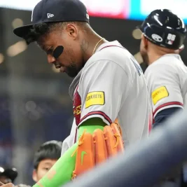 Ronald Acuna Jr. Exits Game with Left Thumb Pain, X-Rays Negative