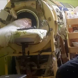 Last American Polio Patient Relying on Iron Lung Dies at 78