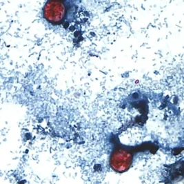 Parasitic Outbreak Hits Michigan and Ohio Following Federal Public Health Funding Cuts