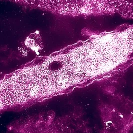 Fifth Person Dies in NYC Legionnaires' Outbreak; 82 Cases Confirmed