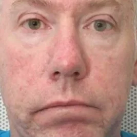 Police Scotland Probes Late Officer Over Serial Sex Attacks